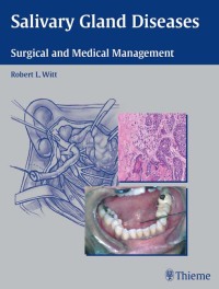 Cover image: Salivary Gland Diseases 1st edition 9781588904140