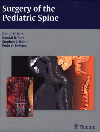 Cover image: Surgery of the Pediatric Spine 1st edition 9781588903426