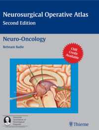 Cover image: Neuro-Oncology 2nd edition 9781588903402