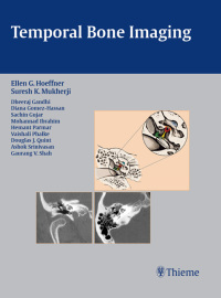 Cover image: Temporal Bone Imaging 1st edition 9781588904010