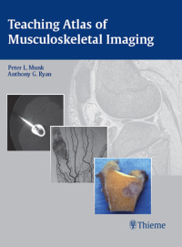 Cover image: Teaching Atlas of Musculoskeletal Imaging 1st edition 9781588903723