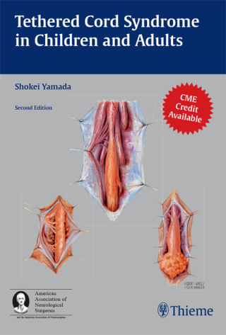 表紙画像: Tethered Cord Syndrome in Children and Adults 2nd edition 9781604062410