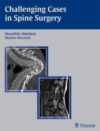 Cover image: Challenging Cases in Spine Surgery 1st edition 9781588903938