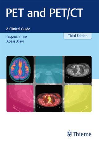 Immagine di copertina: PET and PET/CT 3rd edition 9781626231344