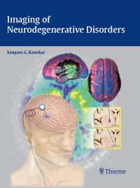 Cover image: Imaging of Neurodegenerative Disorders 1st edition 9781604068542