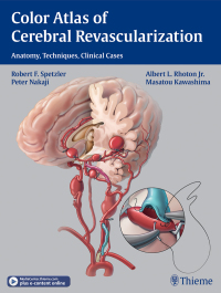 Cover image: Color Atlas of Cerebral Revascularization 1st edition 9781604068221