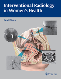 صورة الغلاف: Interventional Radiology in Women's Health 1st edition 9781604060461