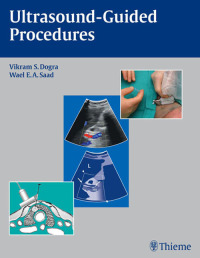 Titelbild: Ultrasound-Guided Procedures 1st edition 9781604061703