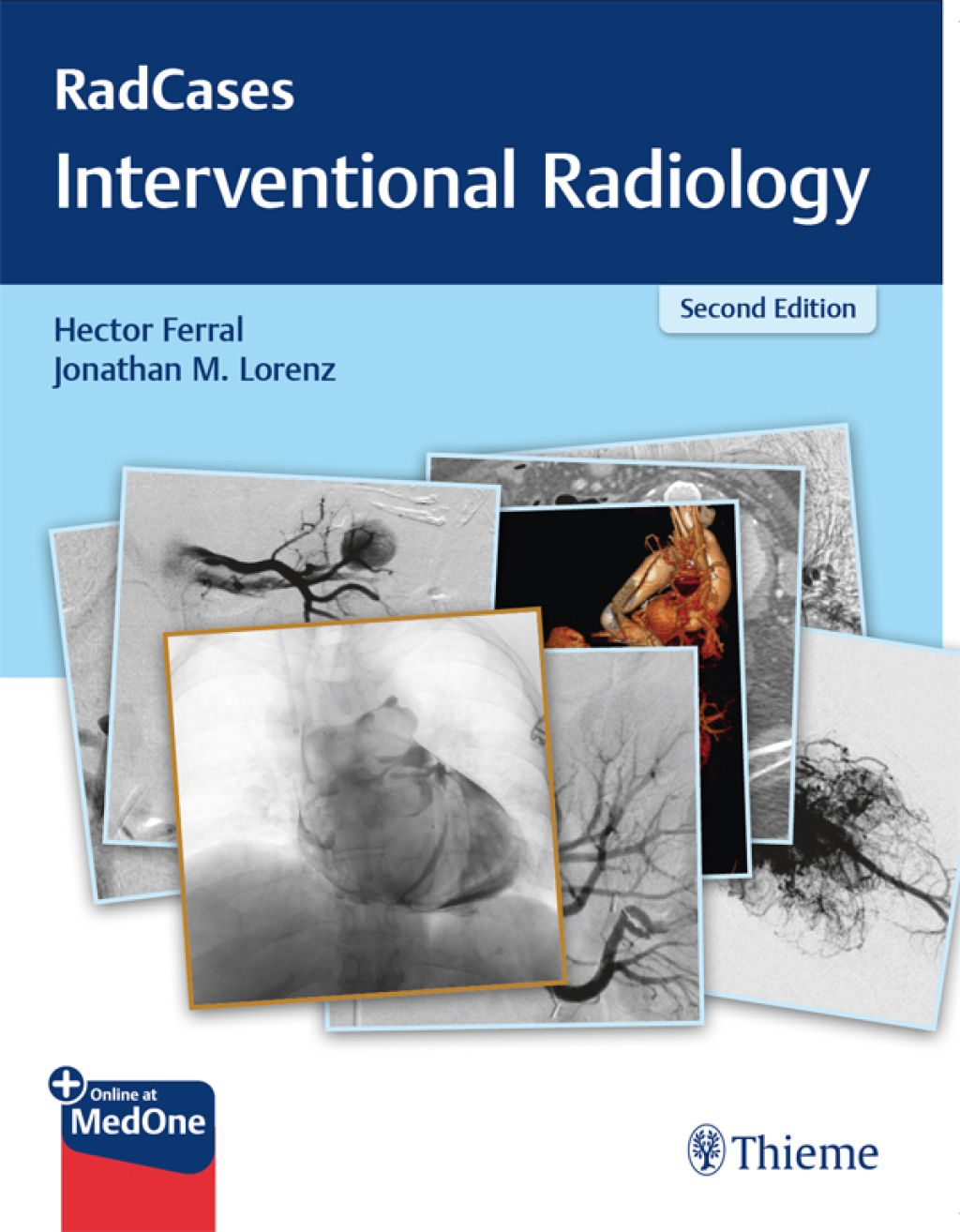 RadCases Q&A Interventional Radiology 2nd Edition