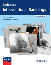 Titelbild: RadCases Q&A Interventional Radiology 2nd edition 9781626232822