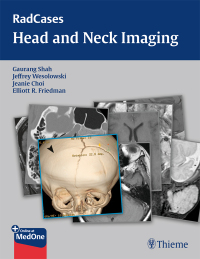 Imagen de portada: RadCases Head and Neck Imaging 1st edition 9781604061932