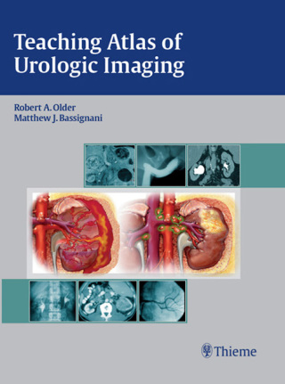 表紙画像: Teaching Atlas of Urologic Imaging 1st edition 9781604060164