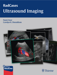 表紙画像: Radcases Ultrasound Imaging 1st edition 9781604063226