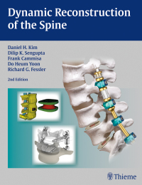 Cover image: Dynamic Reconstruction of the Spine 2nd edition 9781604068733