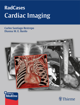 Cover image: Radcases Cardiac Imaging 1st edition 9781604061857
