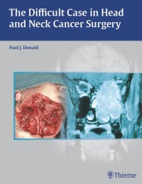 Titelbild: The Difficult Case in Head and Neck Cancer Surgery 1st edition 9780865779846
