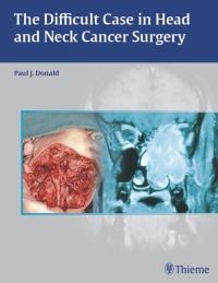 Cover image: The Difficult Case in Head and Neck Cancer Surgery 1st edition 9780865779846