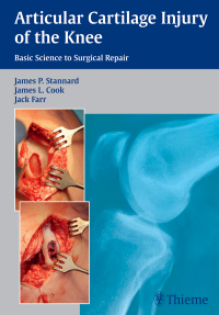 صورة الغلاف: Articular Cartilage Injury of the Knee: Basic Science to Surgical Repair 1st edition 9781604068580
