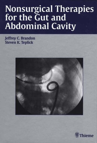 Cover image: Nonsurgical Therapies for the Gut and Abdominal Cavity 1st edition 9780865779976