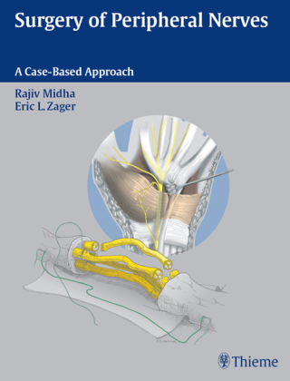 Cover image: Surgery of Peripheral Nerves 1st edition 9780865778603