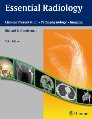 Cover image: Essential Radiology 3rd edition 9781604065732