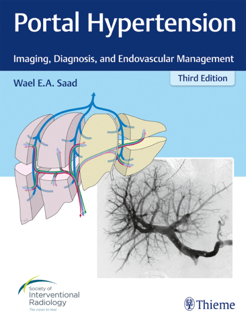 Portal Hypertension: Imaging, Diagnosis, and Endovascular Management, 3rd Edition - FULL INSTANT DOWNLOAD | PDF DOCX EPUB