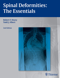 Cover image: Spinal Deformities 2nd edition 9781604064117
