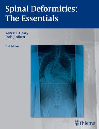 Cover image: Spinal Deformities 2nd edition 9781604064117
