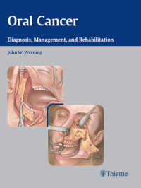 Cover image: Oral Cancer 1st edition 9781588903099