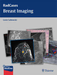 Omslagafbeelding: Radcases Breast Imaging 1st edition 9781604061918