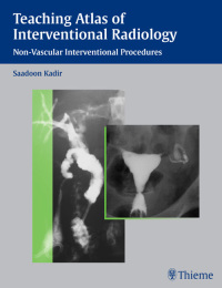 Cover image: Teaching Atlas of Interventional Radiology 1st edition 9781588900562