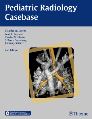Omslagafbeelding: Pediatric Radiology Casebase 2nd edition 9781604069075