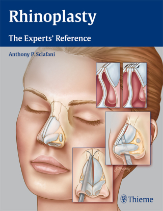 Cover image: Rhinoplasty 1st edition 9781604068672