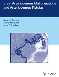 صورة الغلاف: Brain Arteriovenous Malformations and Arteriovenous Fistulas 1st edition 9781626233225