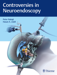 Cover image: Controversies in Neuroendoscopy 1st edition 9781626233539