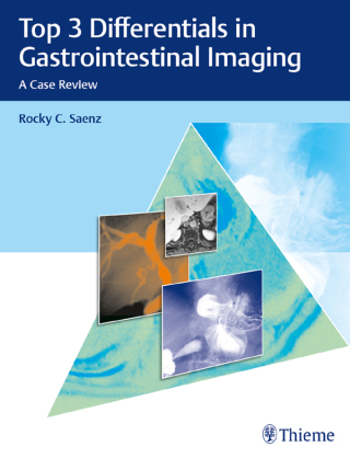 Cover image: Top 3 Differentials in Gastrointestinal Imaging 1st edition 9781626233584