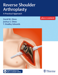 Omslagafbeelding: Reverse Shoulder Arthroplasty 1st edition 9781626233607