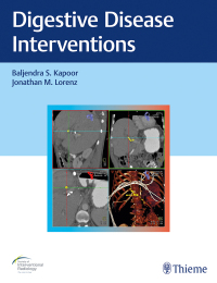 Titelbild: Digestive Disease Interventions 1st edition 9781626233744