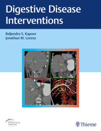 صورة الغلاف: Digestive Disease Interventions 1st edition 9781626233744