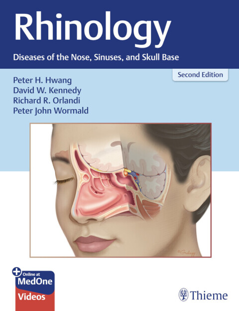 Rhinology: Diseases of the Nose, Sinuses, and Skull Base, 2nd Edition - FULL INSTANT DOWNLOAD | PDF DOCX EPUB