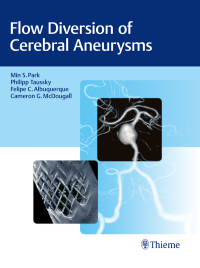 Imagen de portada: Flow Diversion of Cerebral Aneurysms 1st edition 9781626237773
