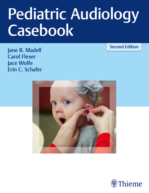 Pediatric Audiology Casebook, 2nd Edition - FULL INSTANT DOWNLOAD | PDF DOCX EPUB