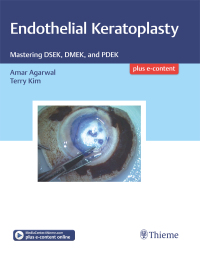 Cover image: Endothelial Keratoplasty 1st edition 9781626234512