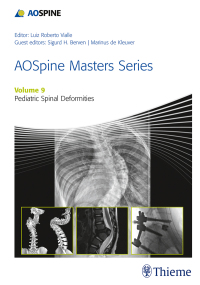 Cover image: AOSpine Masters Series, Volume 9: Pediatric Spinal Deformities 1st edition 9781626234536