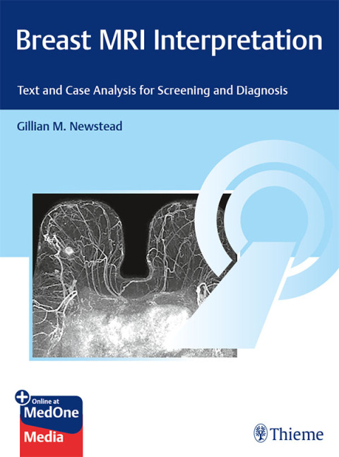 Breast MRI Interpretation: Text and Case Analysis for Screening and Diagnosis, 1st Edition - FULL INSTANT DOWNLOAD | PDF DOCX EPUB