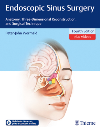 Immagine di copertina: Endoscopic Sinus Surgery 4th edition 9781626234697