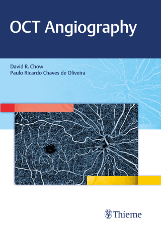Titelbild: OCT Angiography 1st edition 9781626234734