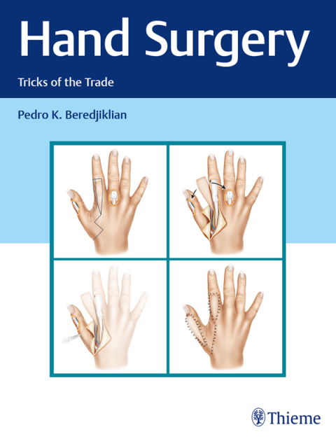Hand Surgery: Tricks of the Trade, 1st Edition - FULL INSTANT DOWNLOAD | PDF DOCX EPUB