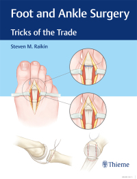 表紙画像: Foot and Ankle Surgery 1st edition 9781626234918