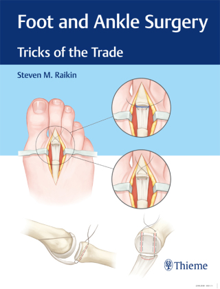 صورة الغلاف: Foot and Ankle Surgery 1st edition 9781626234918